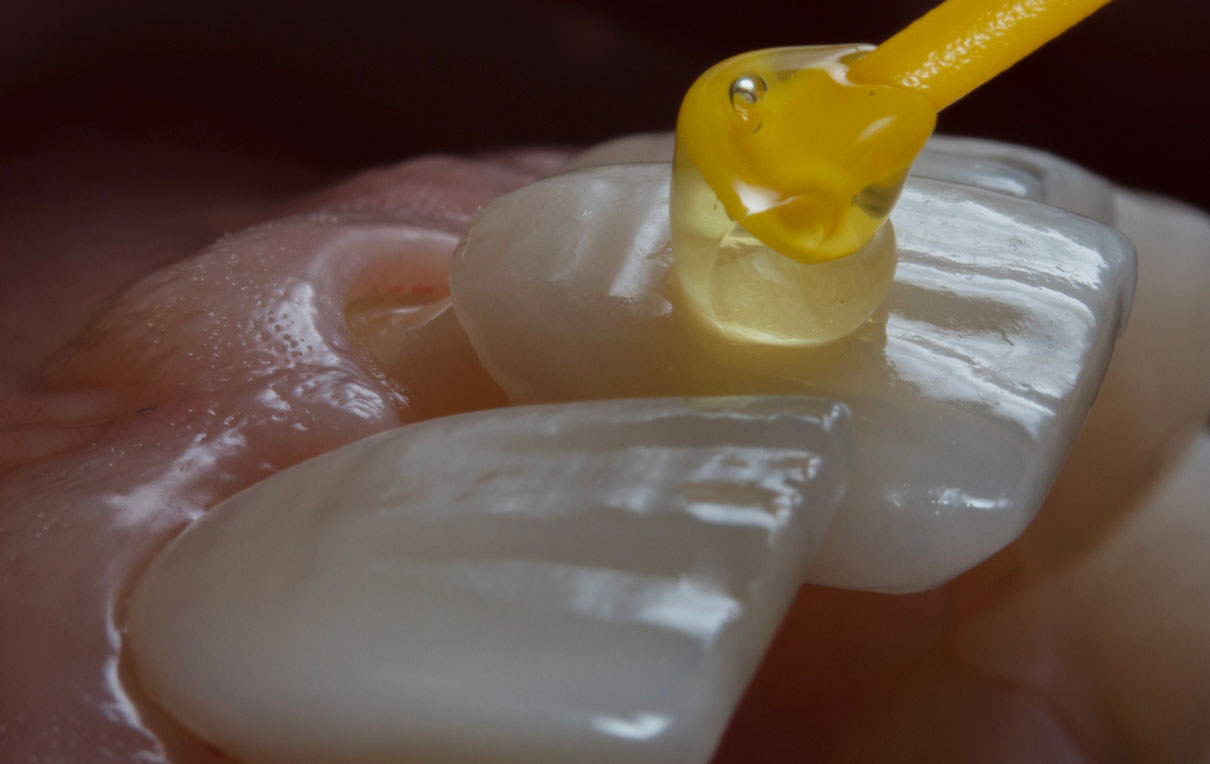 Laboratoire Centre dentaire Belfort Dr Imad Oleiwan